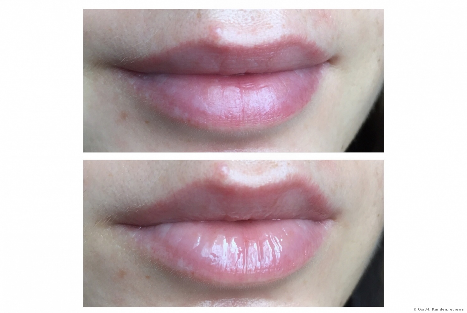 CLINIQUE Superbalm Lip Treatment Lippenbalm Lippenpflege Foto