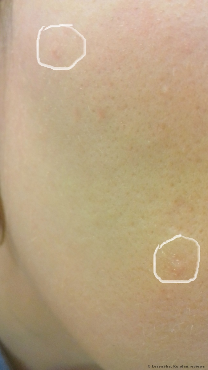  COSRX Acne Pimple Master Patch 