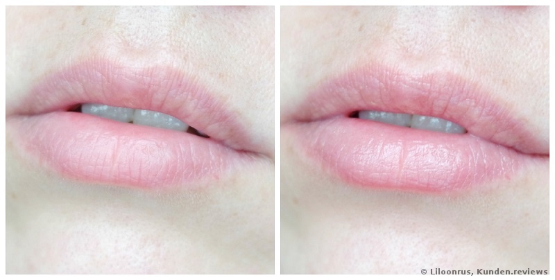 vorher/nacher mit Essence My Beauty Lip Ritual Balms 03 moisturizing